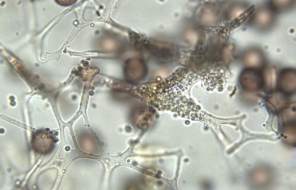 Physarum cf pusillum